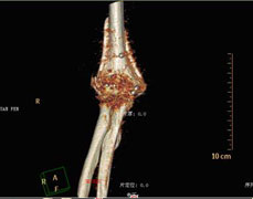 我院放射PACS与HIS系统对接工作已在病区全面实施