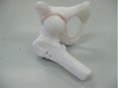 我院骨科开展3D打印技术，实现骨科手术私人定制