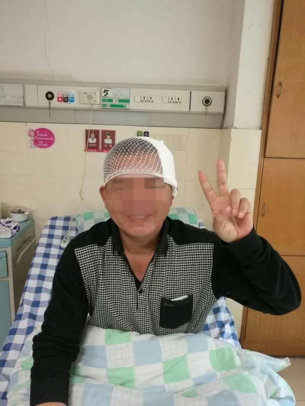 清晨突然头痛欲裂 原来是巨大动静脉畸形惹的祸