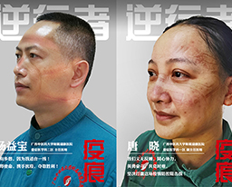 【瑞康战“疫”（四十四）】疫痕：那些镌刻在脸上的美丽故事