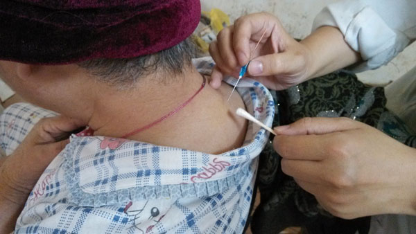 广西中医药大学附属瑞康医院中西医结合康复中心针灸特色简介