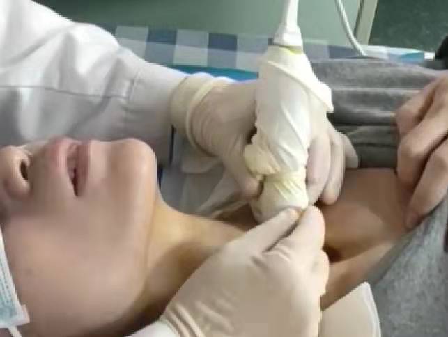 甲状腺穿刺操作.jpg 甲状腺穿刺操作.jpg